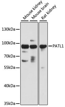 PATL1 Antibody in Western Blot (WB)