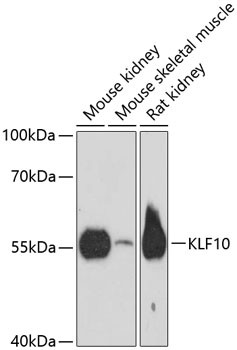KLF10 Antibody in Western Blot (WB)
