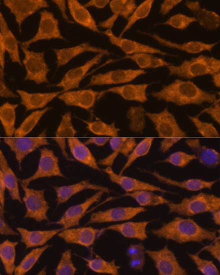 ZC3H7A Antibody in Immunocytochemistry (ICC/IF)