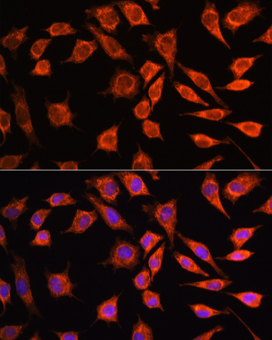 MRPL45 Antibody in Immunocytochemistry (ICC/IF)
