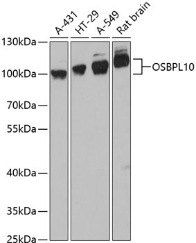 OSBPL10 Antibody in Western Blot (WB)