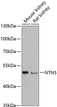 NTN5 Antibody in Western Blot (WB)