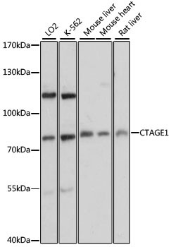 CTAGE1 Antibody in Western Blot (WB)