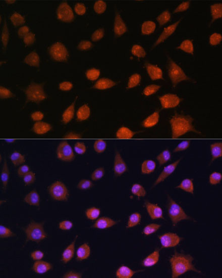 AROS Antibody in Immunocytochemistry (ICC/IF)