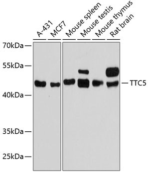 TTC5 Antibody in Western Blot (WB)