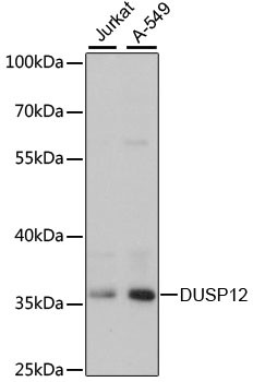 DUSP12 Antibody in Western Blot (WB)