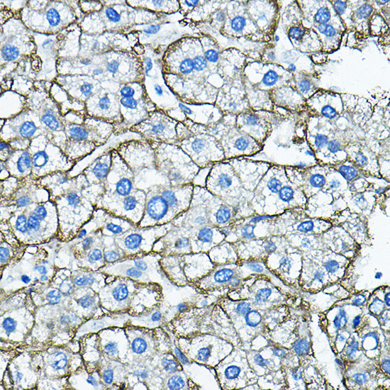 ASGR1 Antibody in Immunohistochemistry (Paraffin) (IHC (P))