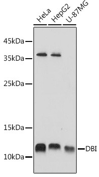 DBI Antibody in Western Blot (WB)