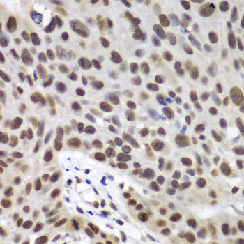 DDX5 Antibody in Immunohistochemistry (Paraffin) (IHC (P))
