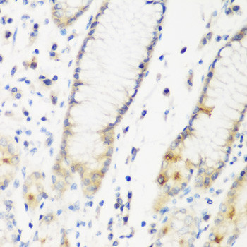 DHODH Antibody in Immunohistochemistry (Paraffin) (IHC (P))