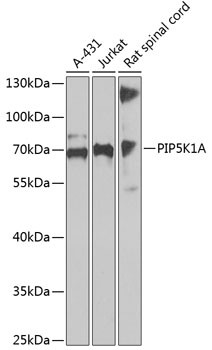 PIP5K1A Antibody in Western Blot (WB)