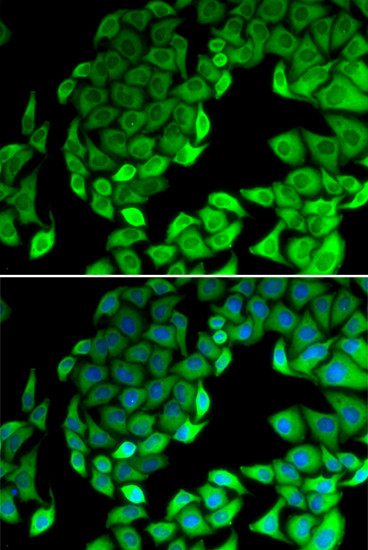 RPL14 Antibody in Immunocytochemistry (ICC/IF)