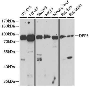 DPP3 Antibody in Western Blot (WB)