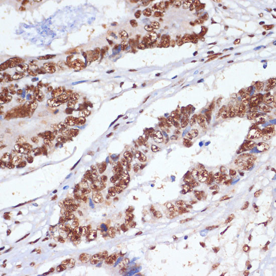 MNAR Antibody in Immunohistochemistry (Paraffin) (IHC (P))