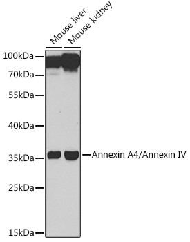 Annexin A4 Antibody in Western Blot (WB)