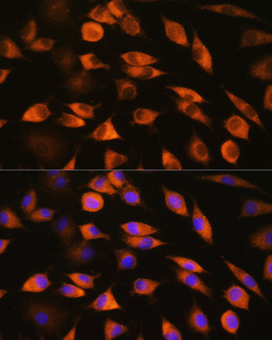 CYP51A1 Antibody in Immunocytochemistry (ICC/IF)