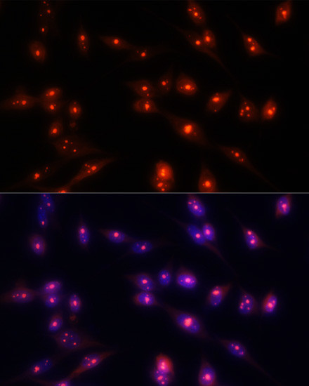 Fibrillarin Antibody in Immunocytochemistry (ICC/IF)