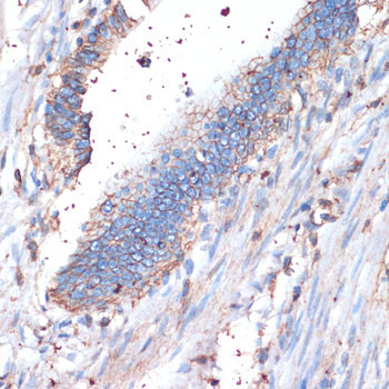 CD44 Antibody in Immunohistochemistry (Paraffin) (IHC (P))