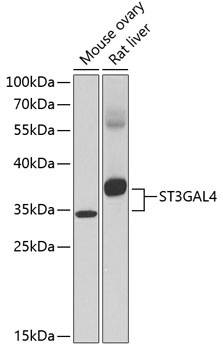 ST3GAL4 Antibody in Western Blot (WB)