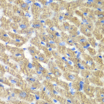 FIBP Antibody in Immunohistochemistry (Paraffin) (IHC (P))