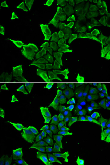 NCS1 Antibody in Immunocytochemistry (ICC/IF)