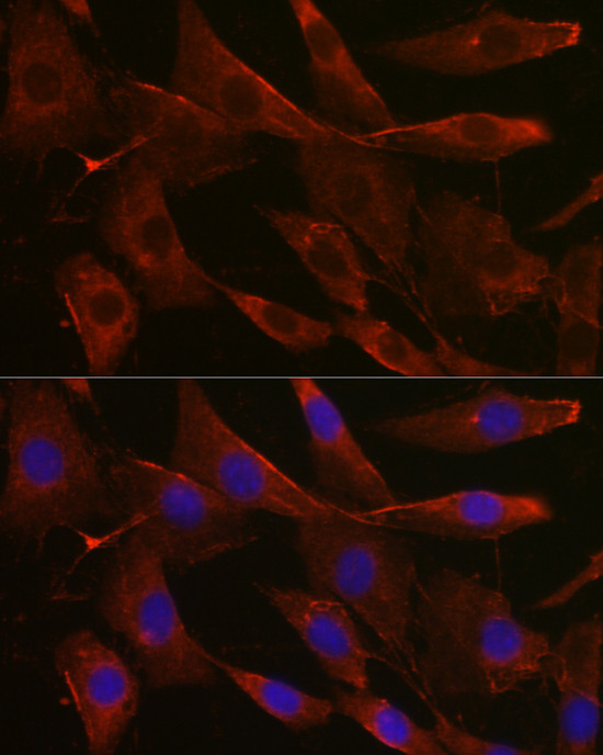 UGT1A1 Antibody in Immunocytochemistry (ICC/IF)