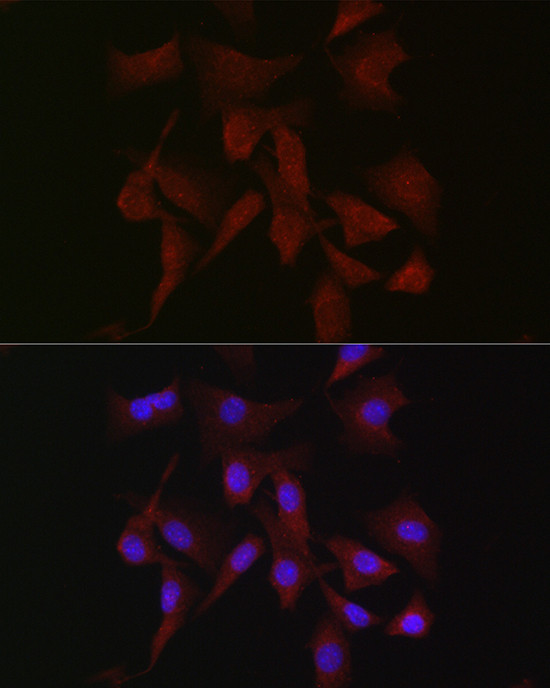 PKC beta Antibody in Immunocytochemistry (ICC/IF)