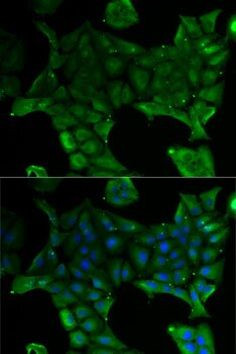 SLC34A1 Antibody in Immunocytochemistry (ICC/IF)