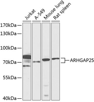 ARHGAP25 Antibody in Western Blot (WB)