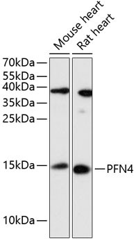 Profilin 4 Antibody in Western Blot (WB)
