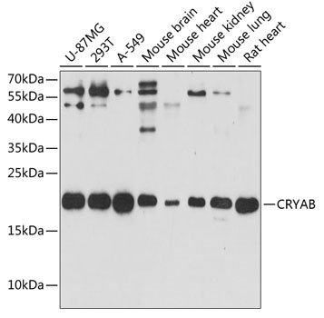 CRYAB Antibody in Western Blot (WB)