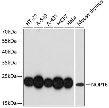 NOP16 Antibody in Western Blot (WB)