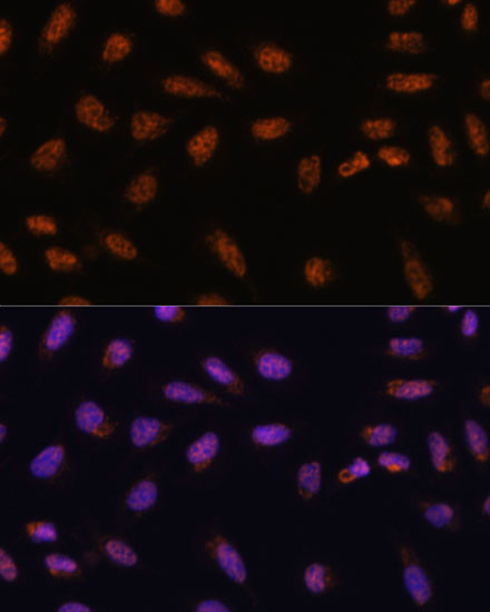 SARNP Antibody in Immunocytochemistry (ICC/IF)