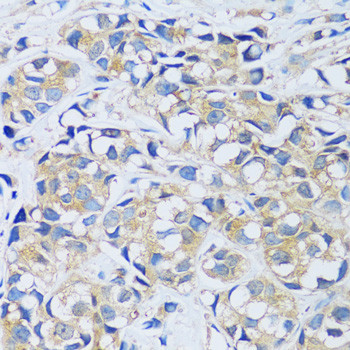 CABP7 Antibody in Immunohistochemistry (Paraffin) (IHC (P))
