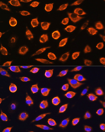 RND1 Antibody in Immunocytochemistry (ICC/IF)