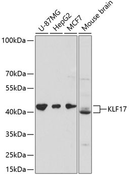 KLF17 Antibody in Western Blot (WB)