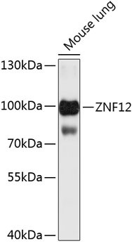 ZNF12 Antibody in Western Blot (WB)