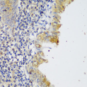 GCC2 Antibody in Immunohistochemistry (Paraffin) (IHC (P))