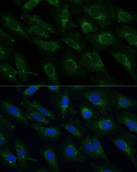 NDUFB4 Antibody in Immunocytochemistry (ICC/IF)