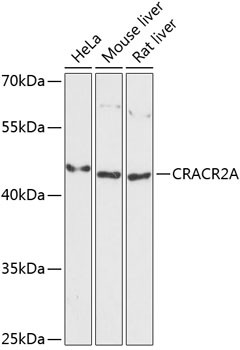 EFCAB4B Antibody in Western Blot (WB)