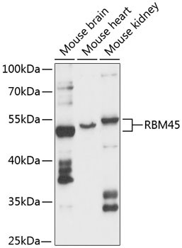 DRB1 Antibody in Western Blot (WB)