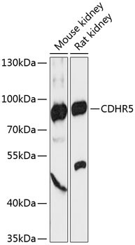 CDHR5 Antibody in Western Blot (WB)
