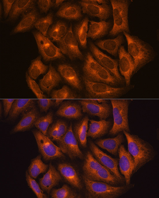 PKM2 Antibody in Immunocytochemistry (ICC/IF)