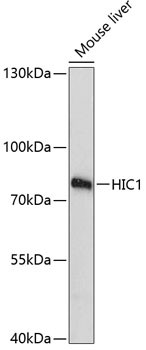 HIC1 Antibody in Western Blot (WB)