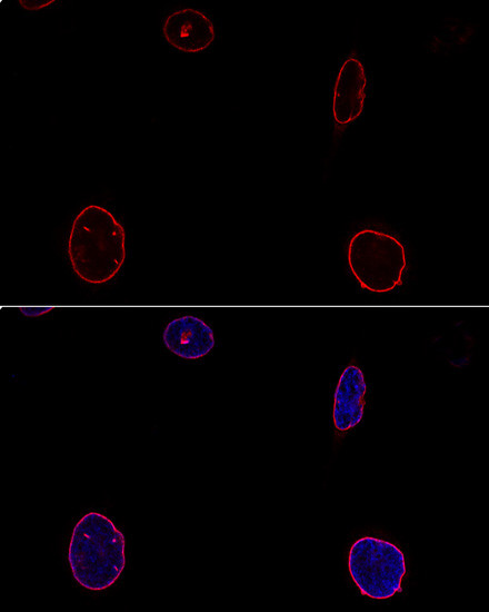 Emerin Antibody in Immunocytochemistry (ICC/IF)
