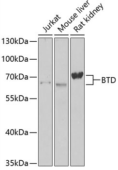 BTD Antibody in Western Blot (WB)