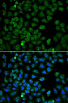 HSC70 Antibody in Immunocytochemistry (ICC/IF)