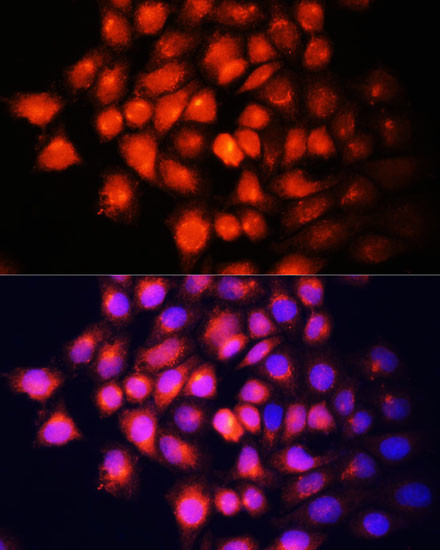 IGF2 Antibody in Immunocytochemistry (ICC/IF)
