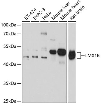 LMX1B Antibody in Western Blot (WB)