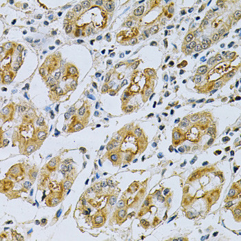Maspin Antibody in Immunohistochemistry (Paraffin) (IHC (P))